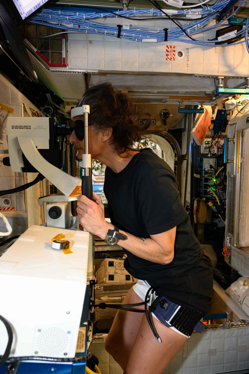 Különös változásokon megy át az űrhajósok teste a világűrben