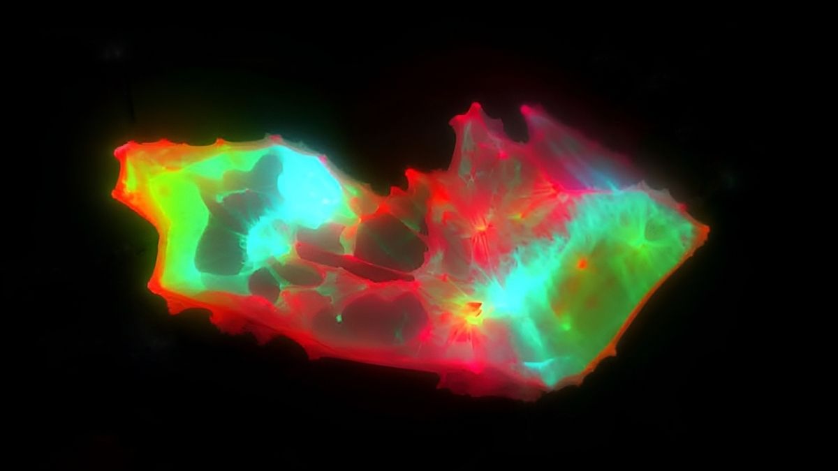 Végre rájöttek, mi okozhatja a long Covid tüneteit