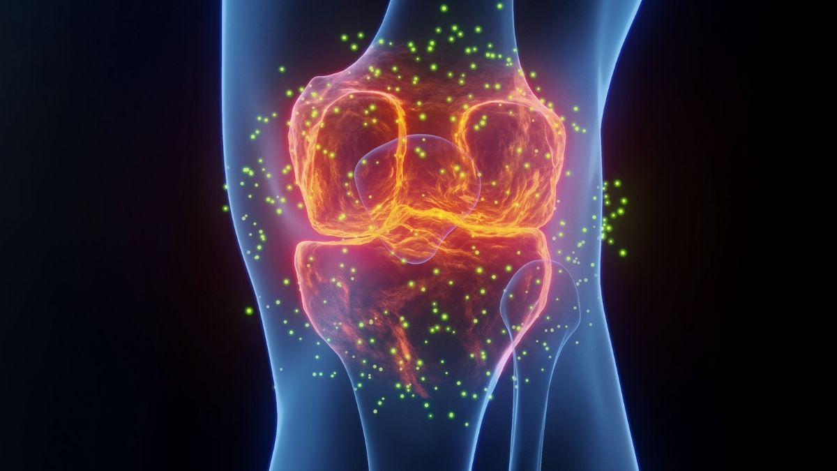 Az ízületi fájdalom legjobb gyógyszere nem az, amire gondolsz